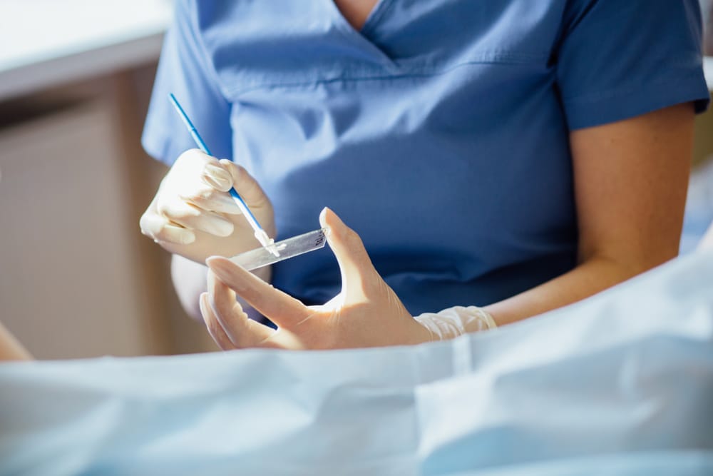 Vaginal,Smear.,Close,Up.
